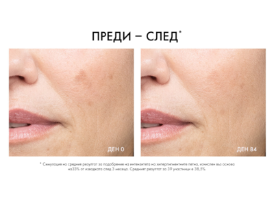 PIGMENT SPECIALIST B3